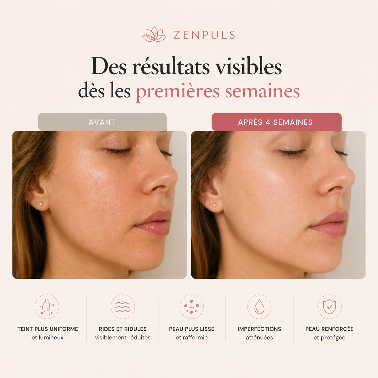 Masque LED Anti-Âge — Thérapie Lumineuse Professionnelle à Domicile