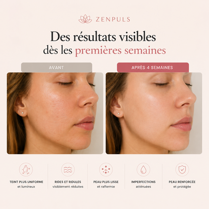 Masque LED Anti-Âge — Thérapie Lumineuse Professionnelle à Domicile